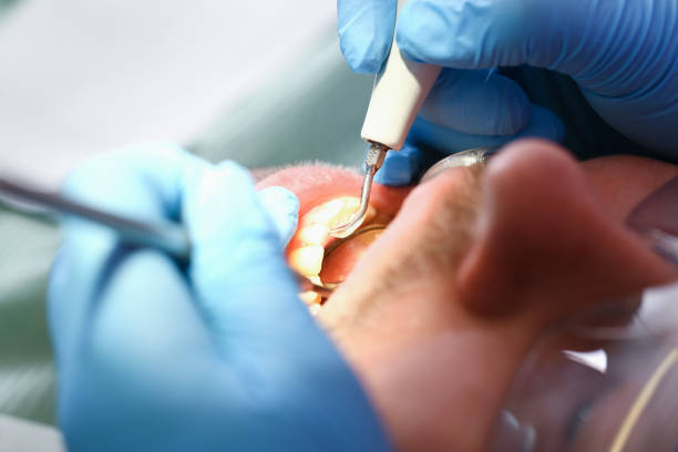 Best 24-Hour Emergency Dentist in East Point, GA