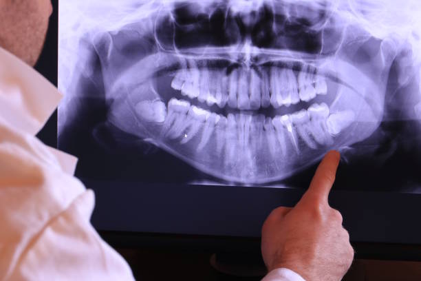 Best Weekend Emergency Dentist in East Point, GA