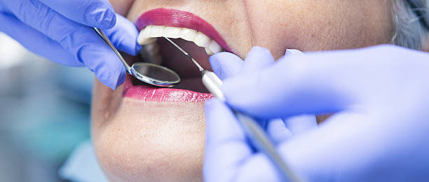 Best After-Hours Dental Trauma Care in East Point, GA